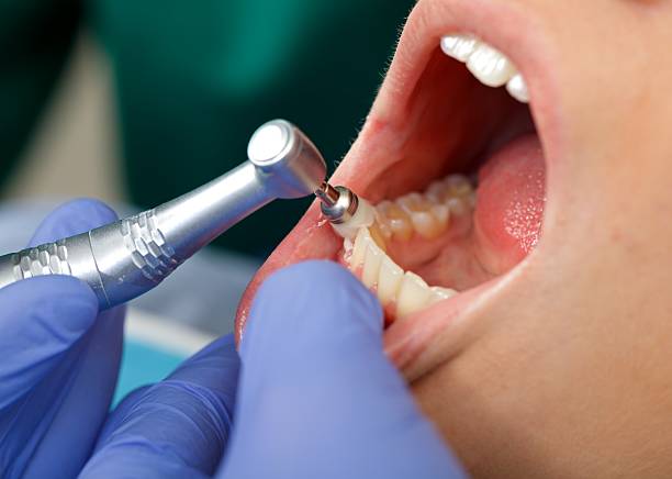 TMJ/TMD Treatment in Altamont, IL